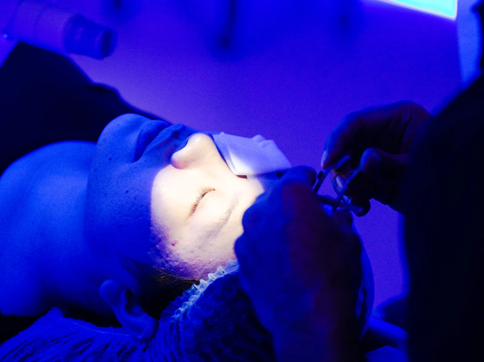 LASIK vs. SMILE for dry eyes